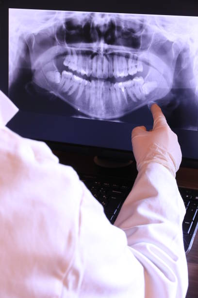 Best Broken or Chipped Tooth Repair in Athens, MI