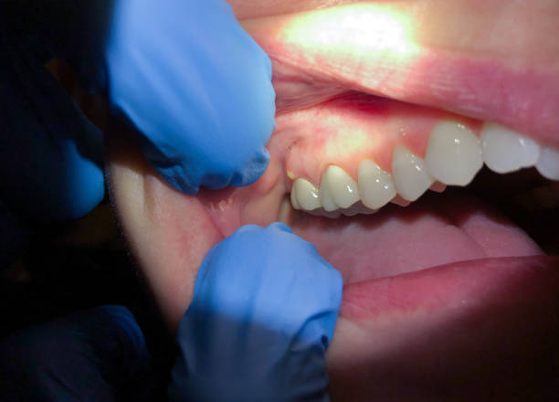 Best Emergency Pediatric Dental Care in Athens, MI